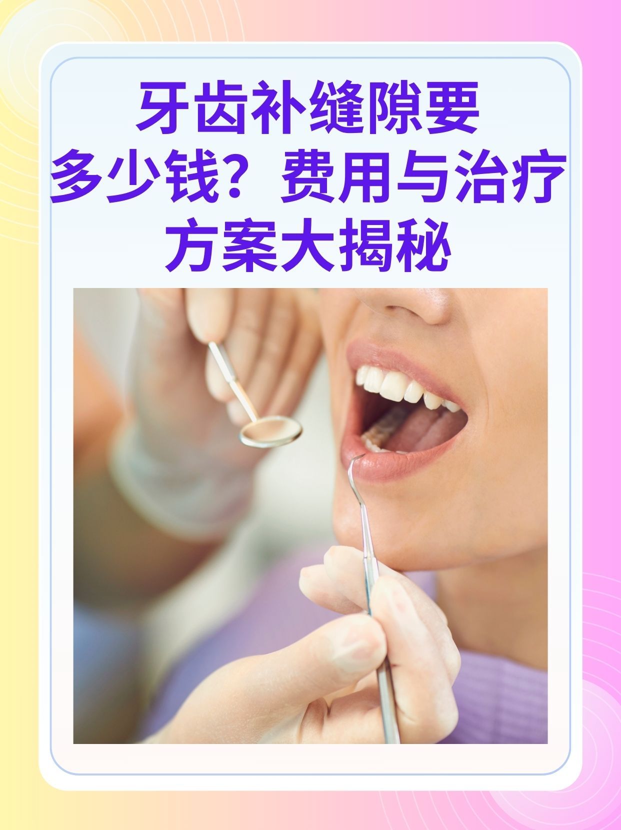 焦作补牙医保可以报销吗(补牙医保可以报销吗 哪些可以报销呢)